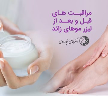 مراقبت های قبل و بعد از لیزر مو های زائد