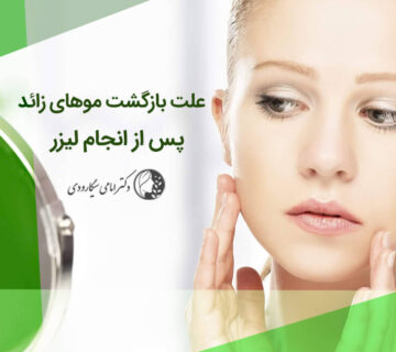 علت برگشت موهای زائد بعد از انجام لیزر