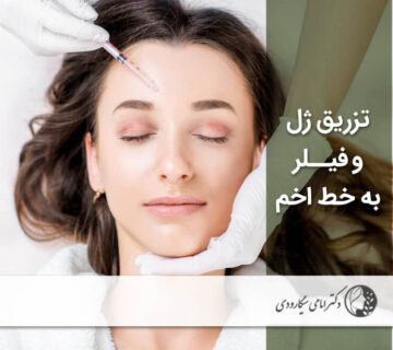 تزریق ژل و فیلر خط اخم