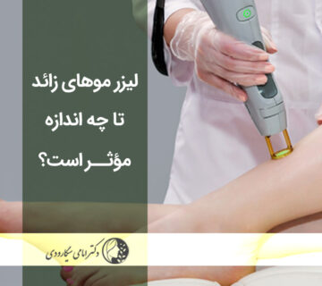 تأثیر لیزر موهای زائد