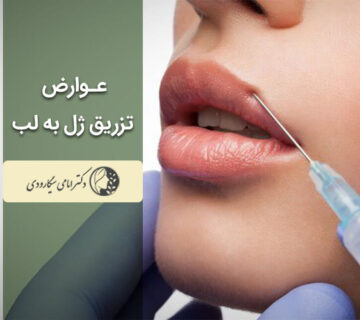 عوارض ژل لب