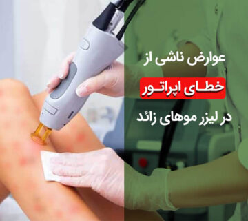 عوارض خطای اپراتور لیزر