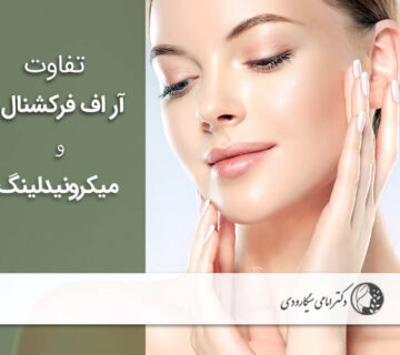 مقایسه لیزر آر اف و میکرونیدلینگ