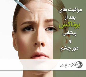 مراقبت بعد از بوتاکس پیشانی و دور چشم