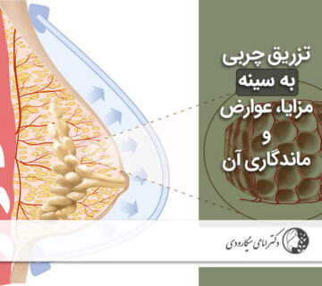 تزریق چربی به سینه