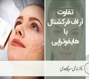 مقایسه آر اف و هایفوتراپی