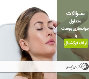 سوالات متدوال لیزر آر اف