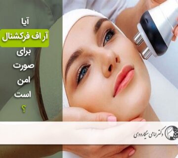 ایمن بودن لیزر آر اف