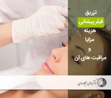  تزریق فیلر پیشانی