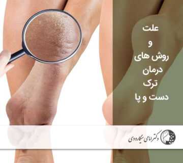 علت و روش های درمان ترک دست و پا