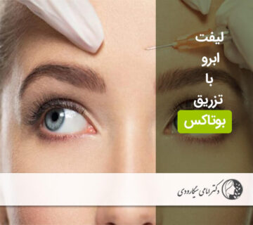 لیفت ابرو با تزریق بوتاکس  