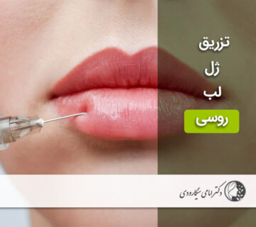 تزریق ژل لب روسی