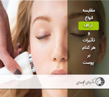 مقایسه انواع آر اف