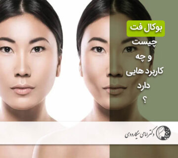 بوکال فت