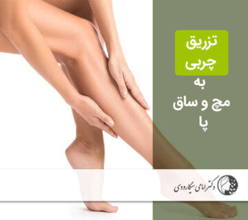 تزریق چربی به مچ و ساق پا