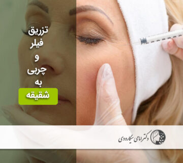 تزریق فیلر و چربی به شقیقه