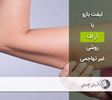 لیفت بازو با آر اف