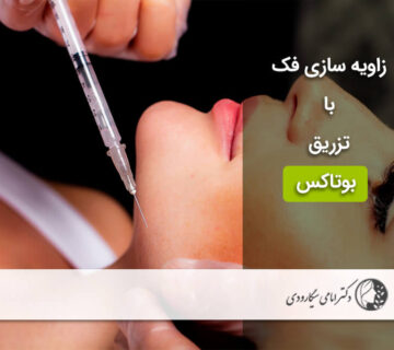 زاویه سازی فک با تزریق بوتاکس