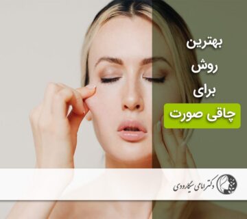 بهترین روش چاقی صورت