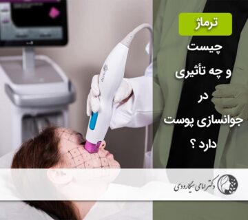 ترماژ