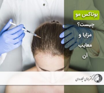 بوتاکس مو