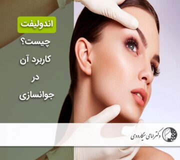 اندولیفت