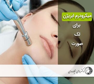 میکرودرم ابریژن
