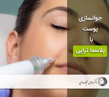 پلاسما تراپی