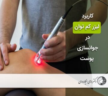 لیزر کم توان در جوانسازی پوست