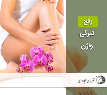 رفع تیرگی واژن