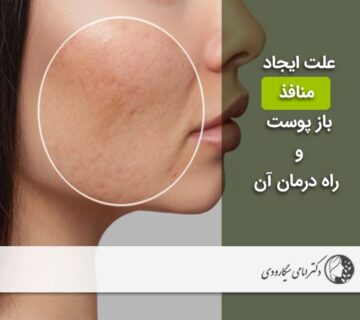 منافذ باز پوست
