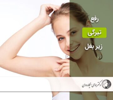 تیرگی زیر بغل
