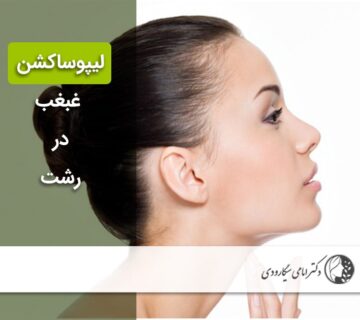 لیپوساکشن غبغب در رشت