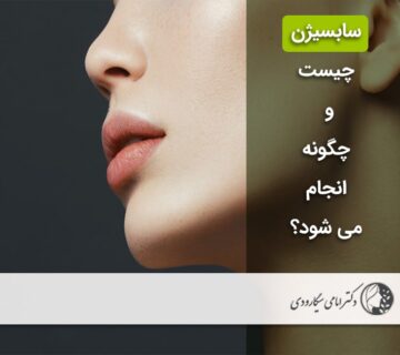 سابسیژن