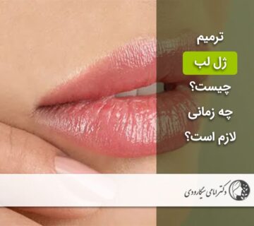 ترمیم ژل لب