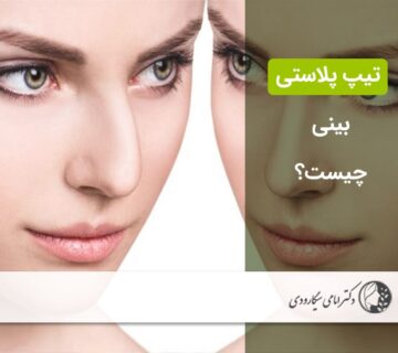 تیپ پلاستی بینی
