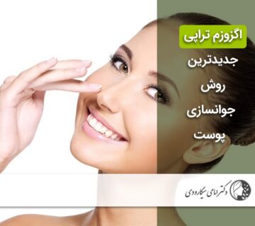 اگزوزم تراپی