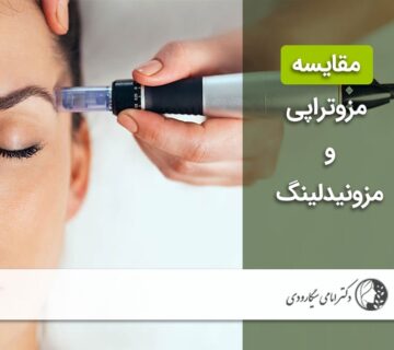 مقایسه مزوتراپی و مزونیدلینگ
