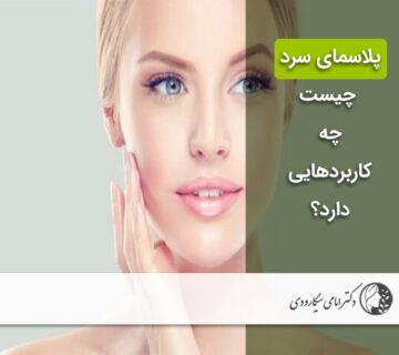 پلاسمای سرد