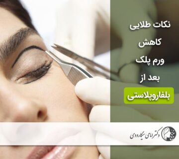کاهش ورم پلک بعد از بلفاروپلاستی