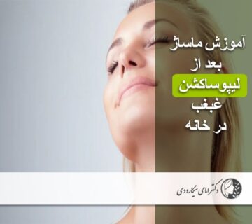 ماساژ بعد از لیپوساکشن غبغب