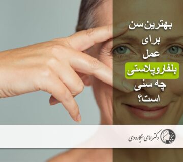 بهترین سن برای بلفاروپلاستی