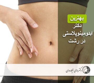 بهترین دکتر ابدومینوپلاستی در رشت